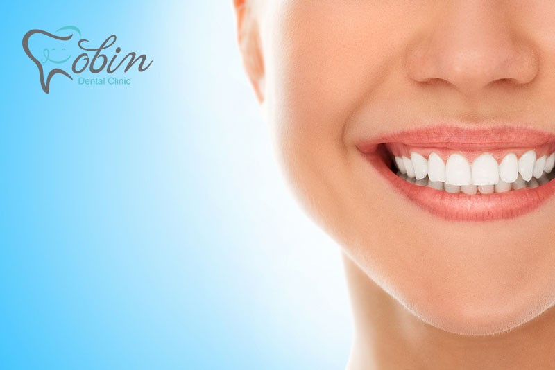 کامپوزیت دندان یا بلیچینگ دندان